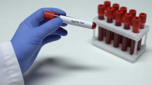 Blood Test Sample for Syphilis in Lab