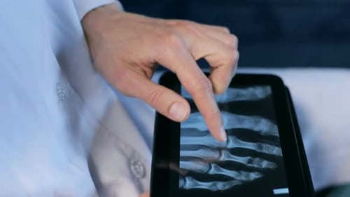 The doctor examines the x-ray picture on the patient's tablet in the clinic.