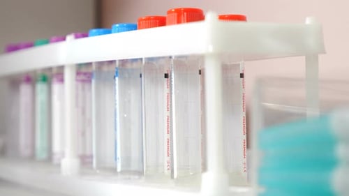 Test Tubes with Blood in a Lab