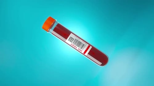 Medical HIV Blood Test Tube Animation for Diagnosis