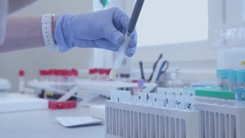 Lab Technician Handling Test Tubes with Pipette