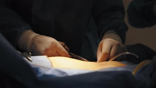 Close Up of a Surgeon's Hand Suturing a Wound After a Successful Operation