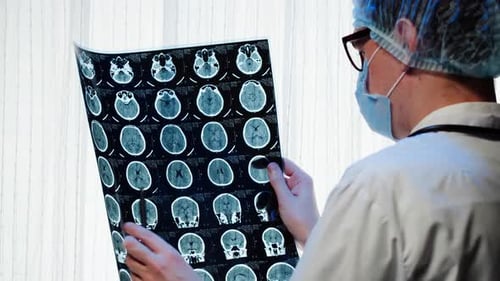Medical Professional Analyzing Brain Scan in Hospital Setting