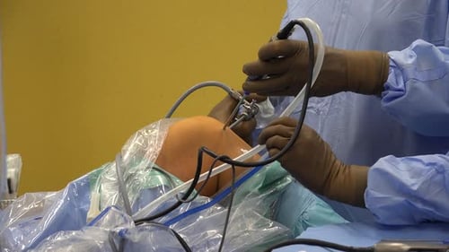 Knee Arthroscopy
