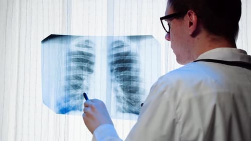 Doctor Examines Chest X-ray in Hospital Close Up