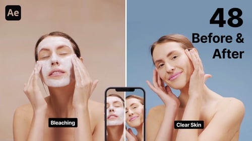 Before and After - Horizontal & Vertical