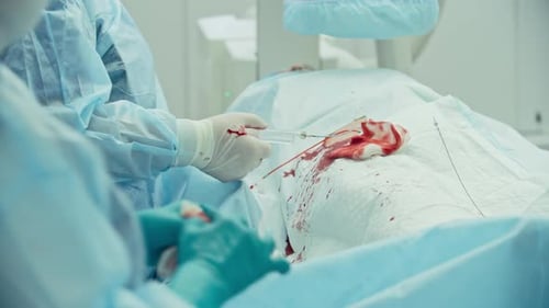 Bypass-Transplantat der Koronararterien