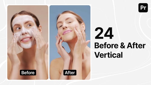 Before and After - Instagram Stories