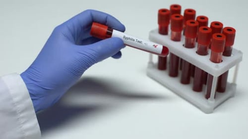 Hand in Glove Holds Syphilis Test Tube