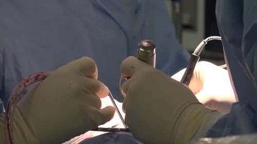 Surgeon's Hands Perform Surgery in Hospital Operating Room