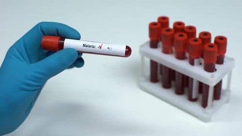 Test de paludisme négatif, médecin montrant un échantillon de sang, recherche en laboratoire, soins de santé