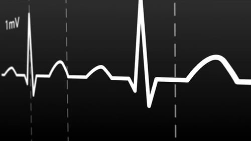 Animation of Intensive Care Unit monitor showing normal values for vital signs.