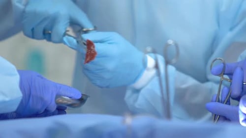 Operating Doctor Resecting Tumor Putting Organ Part in Surgical Tray, Histology