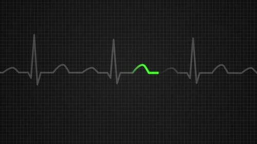 Animation of a diagram showing values for a death on electrocardiograph screen