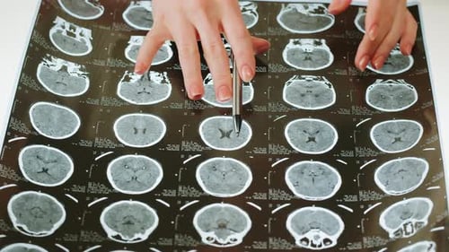 Health Professional Reviewing Brain Scan Results