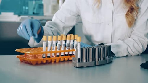 Stand with Test Tubes for Blood Tests. Lab Assistant in Gloves Putting Blood Test Tubes in Rack or