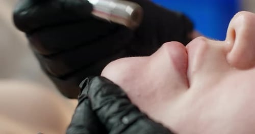 Cosmetology Procedure of the Machine Exfoliation Face Peeling 60p Prores HQ