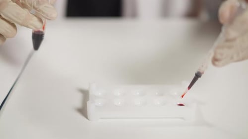 Lab Assistant Drips Blood Into Well Plate in Hospital