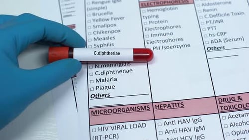 C Diphtheriae, médico que comprueba la enfermedad en el laboratorio en blanco que muestra la muestra de sangre en el tubo