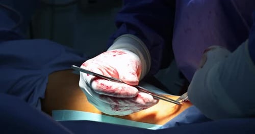 Surgeon Performing Operation with Scalpel and Forceps