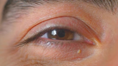 Close Up of Brown Eye Blinking