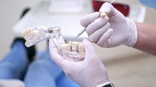 Doctor holding teeth jaw model. Teeth model holding by doctor in dentistry clinic