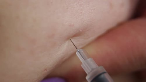 Nahaufnahme einer Frau macht einen Schuss Insulin in die Fettfalte auf dem Bauch