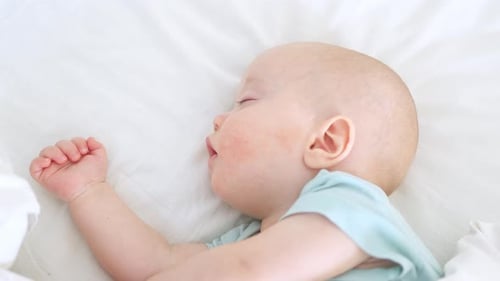 Close-Up of Bald Infant Sleeping Peacefully