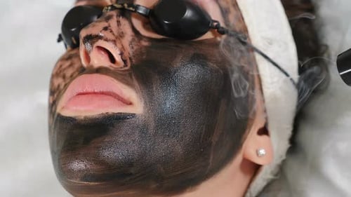 Woman Receives Carbon Laser Facial Treatment