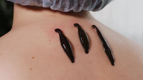 Trois sangsues sur le cou du patient en gros plan