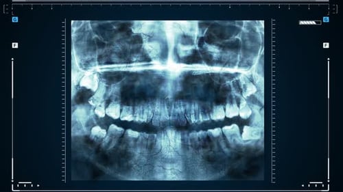 Futuristic Dental X-Ray Scan with Pulsating Veins HUD Interface