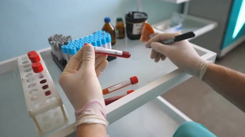 Gloved Hands Working with Blood Test Tubes