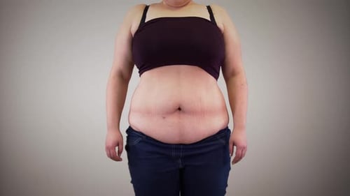 Mid Shot of Overweight Person Posing