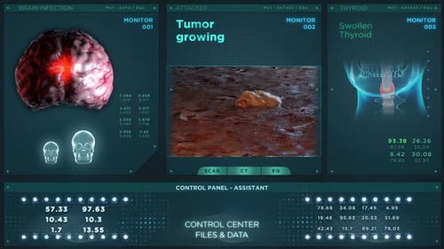 Futuristic Medical Diagnostic Interface with Animated Organ Scans