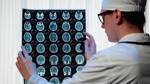 Doctor Analyzing Brain Scan in Hospital Setting