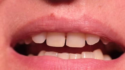 Extreme Close Up of Mouth and Teeth