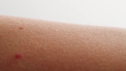 Detailed Close-Up of Human Skin Texture