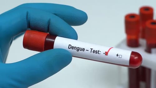 Dengue-Test, Doctor Holding Blood Sample in Tube Close-Up, Health Check-Up