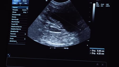 Diagnóstico por ultrasonido en clínica veterinaria.