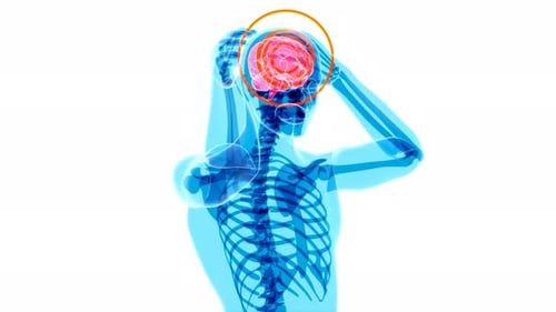 4K anatomy concept of a headache