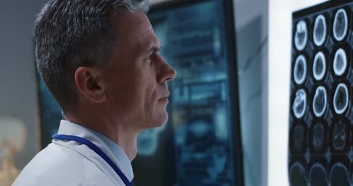 Medical Professional Reviewing Brain Scan in Hospital