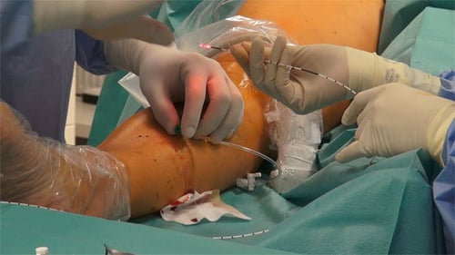 Medical Personnel Performing Surgical Procedure in Hospital Setting