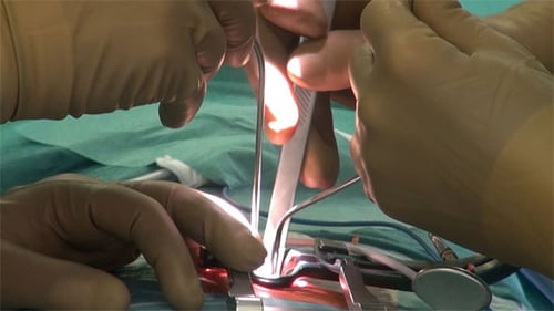 Surgeons Perform Delicate Surgical Procedure in Operating Room