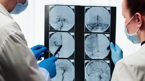 Doctors Examining Xraybrain MRI