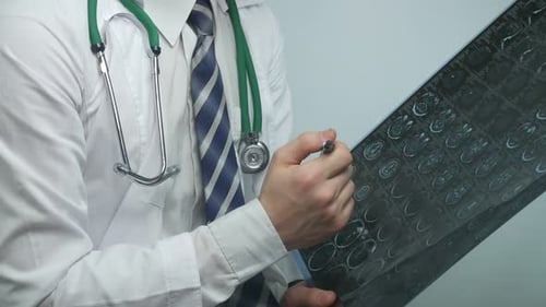 Doctor Examining The X Ray Of The Brain In A Modern Office