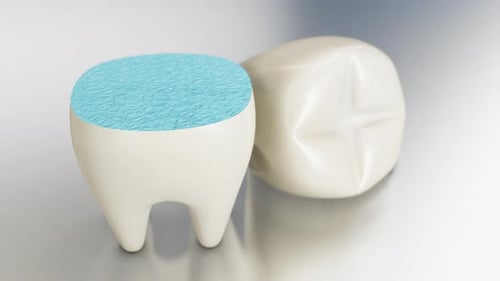 Tooth 3d printing.