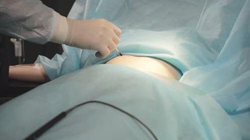 Cleaning and Preparation of the Skin Before Surgery with Iodine Solution