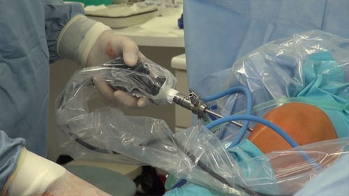 Surgeon Performing Arthroscopic Knee Surgery in Hospital