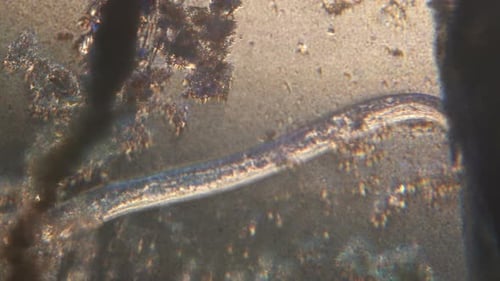 Microscopy of parasite worm nematode