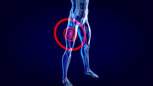 3D Human Anatomy Squat Exercise Highlighting Pain